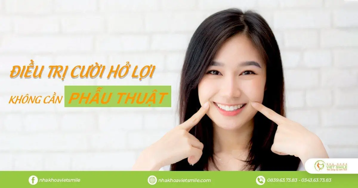 VietSmile Trị Cười Hở Lợi