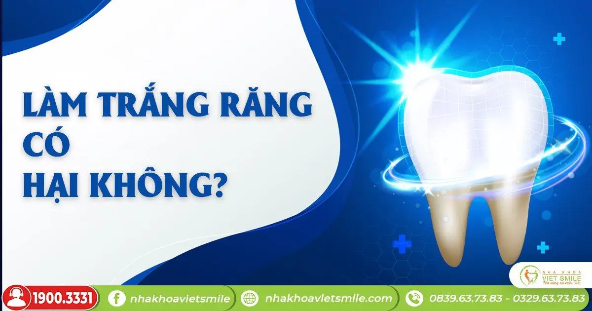 Làm trắng răng có hại không?