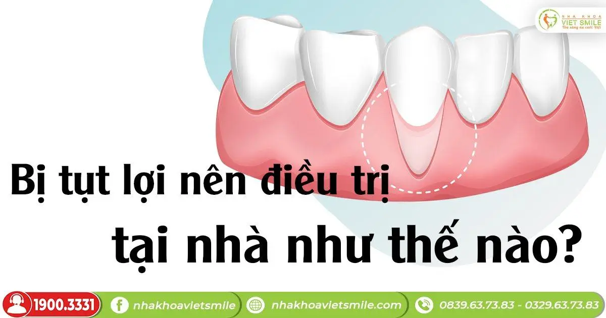 Bị tụt lợi nên điều trị tại nhà như thế nào?