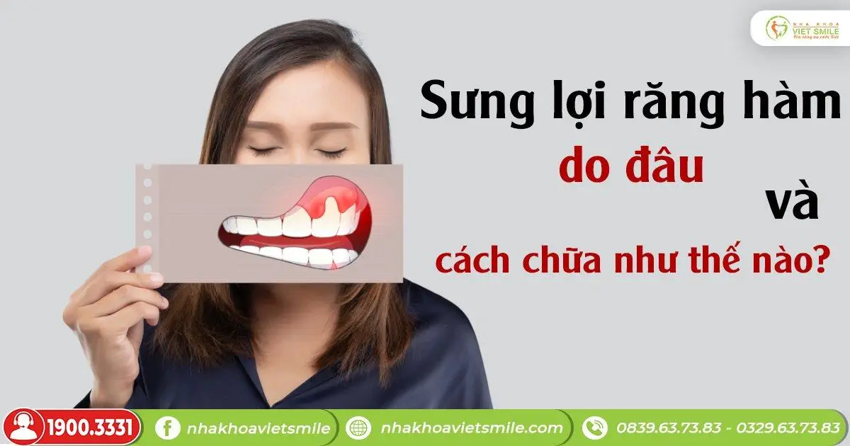 Sưng lợi răng hàm do đâu và cách chữa như thế nào?