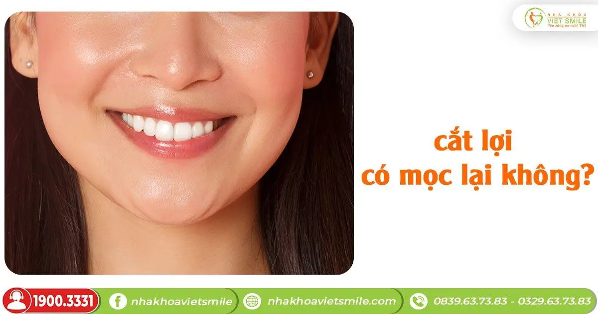 Cắt lợi có mọc lại