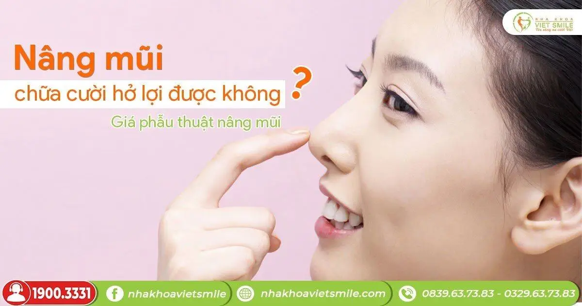 Nâng mũi chữa cười hở lợi được không? Giá phẫu thuật nâng mũi