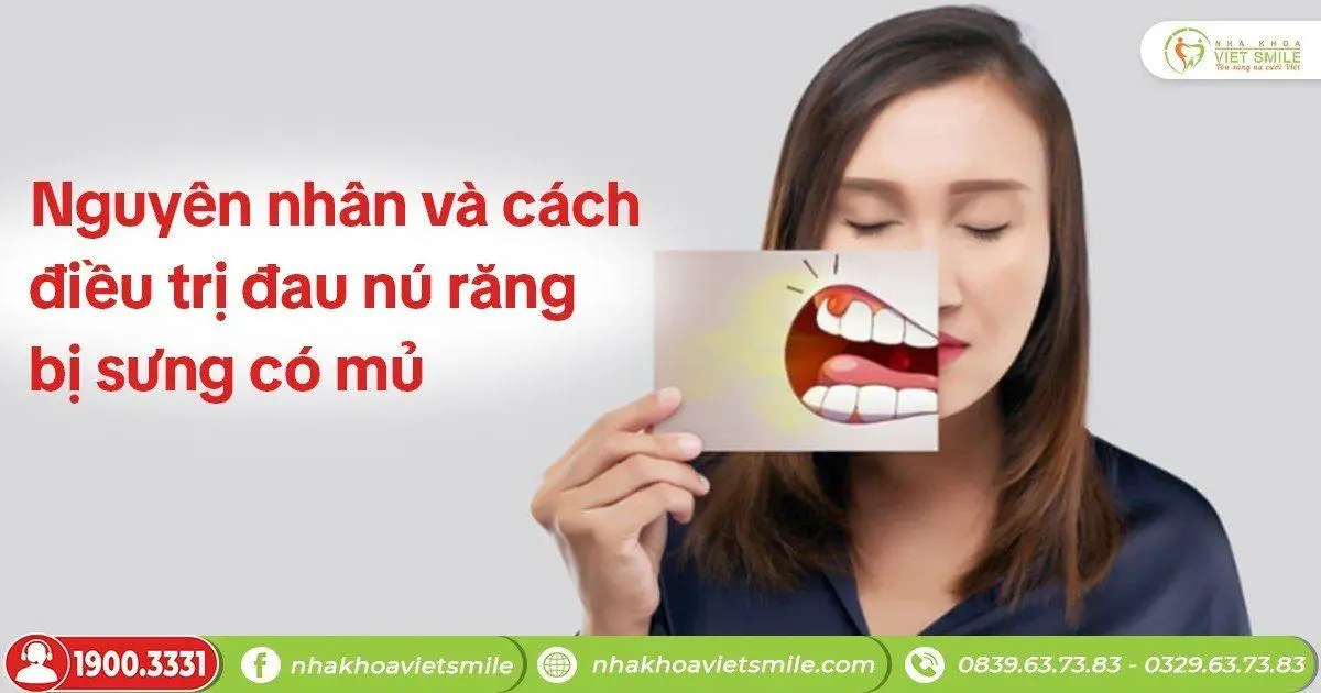 Nguyên nhân và cách điều trị đau nú răng bị sưng có mủ