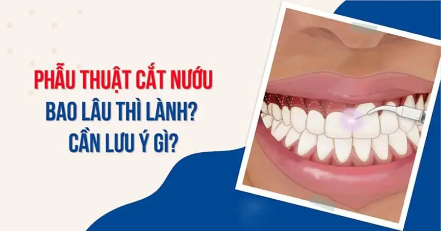 Cắt lợi bao lâu thì lành thương