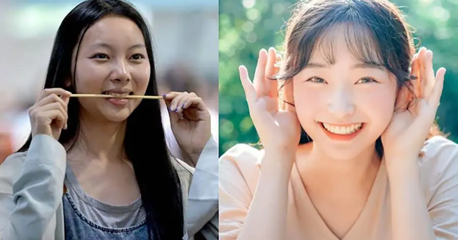 Chữa cười hở lợi không phẫu thuật khi tập cười với đũa