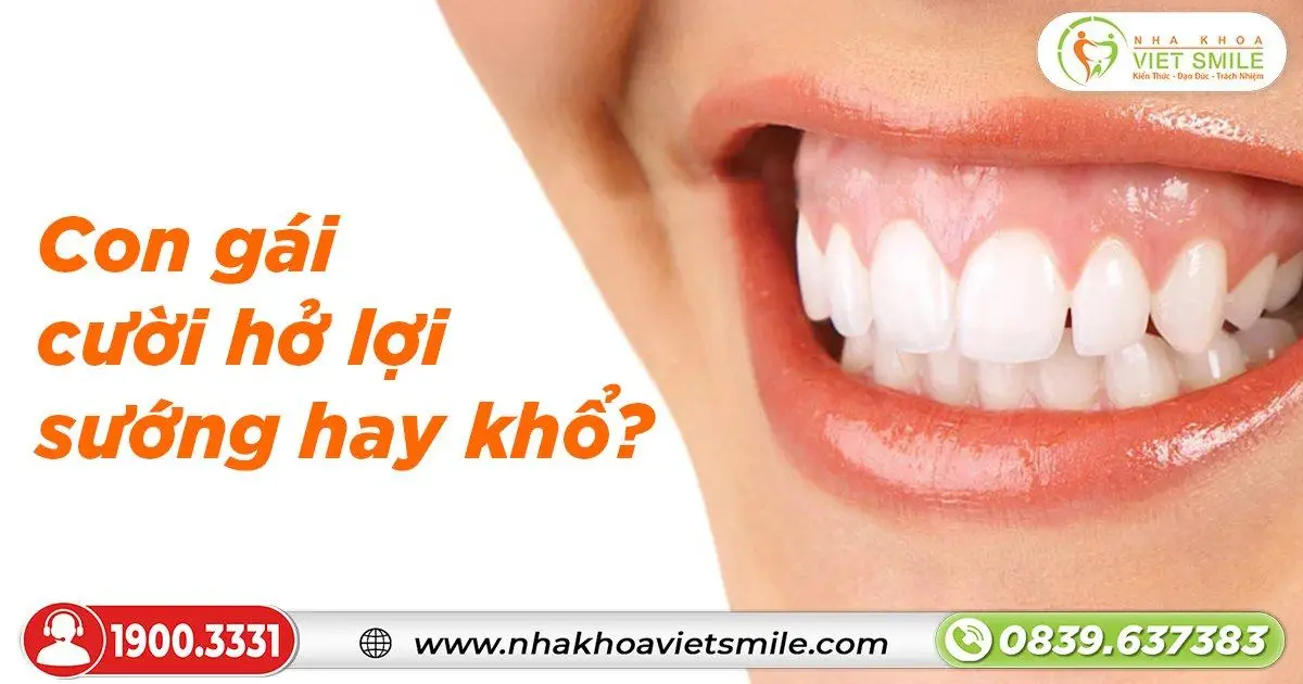 Con gái cười hở lợi sướng hay khổ?