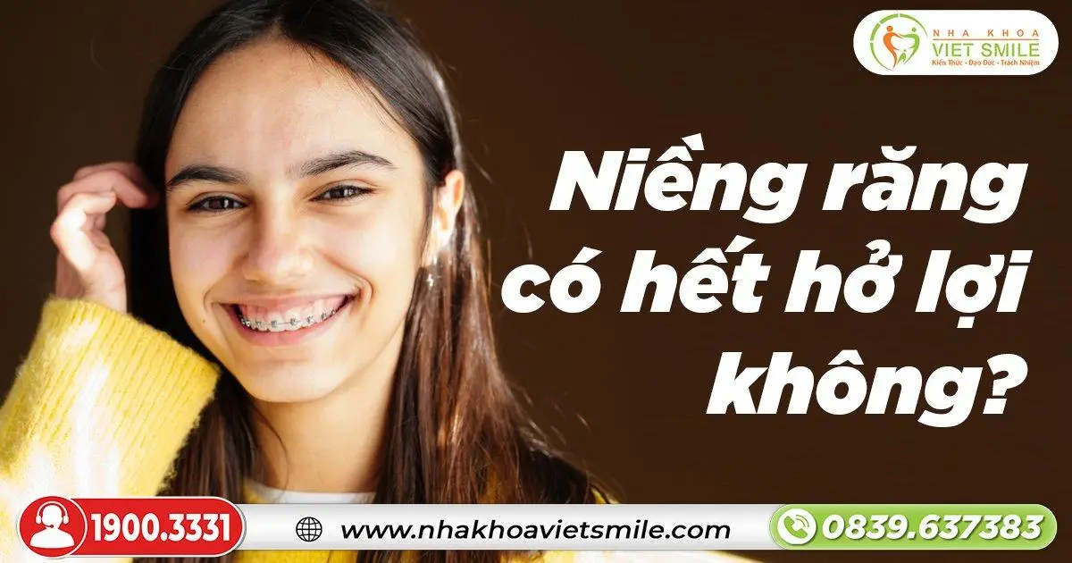 Niềng răng có hết hở lợi không?