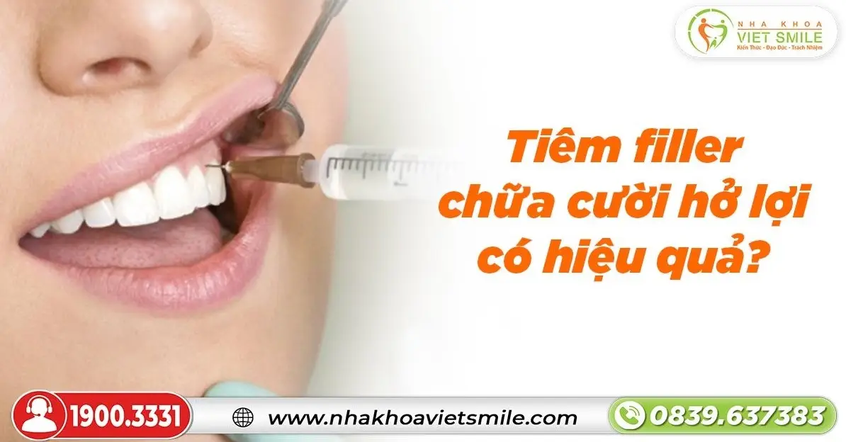 Tiêm filler chữa cười hở lợi có hiệu quả?