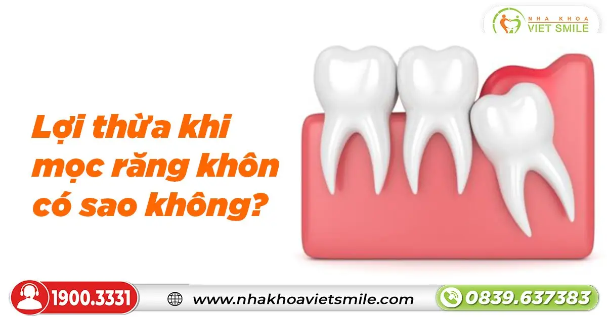 Lợi thừa khi mọc răng khôn có sao không? 