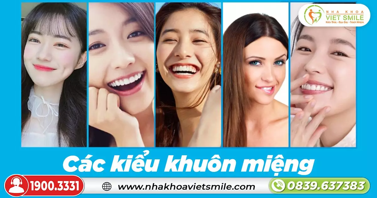 cac kieu khuon mieng