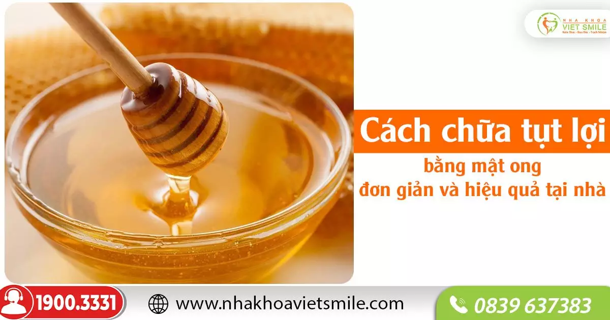 Cách chữa tụt lợi bằng mật ong đơn giản và hiệu quả tại nhà