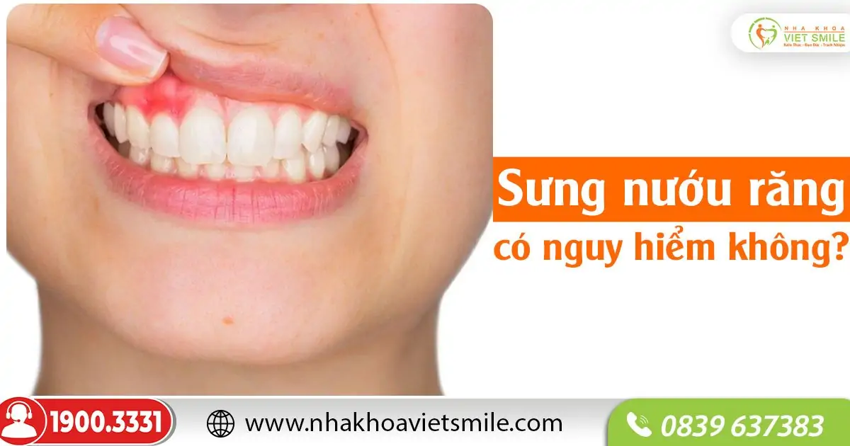 Sưng nướu răng có nguy hiểm không?