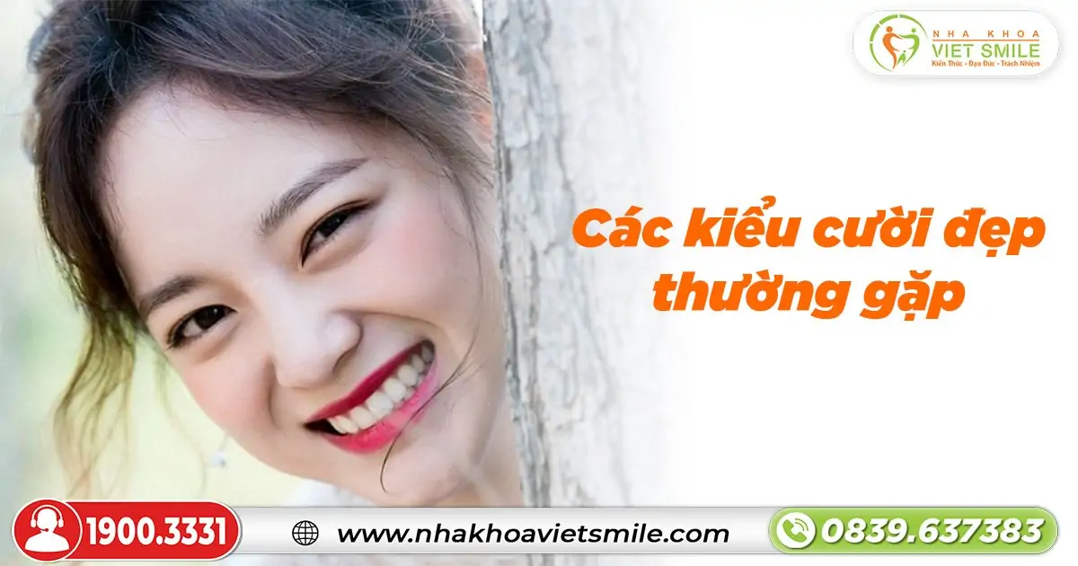 Các kiểu cười đẹp thường gặp