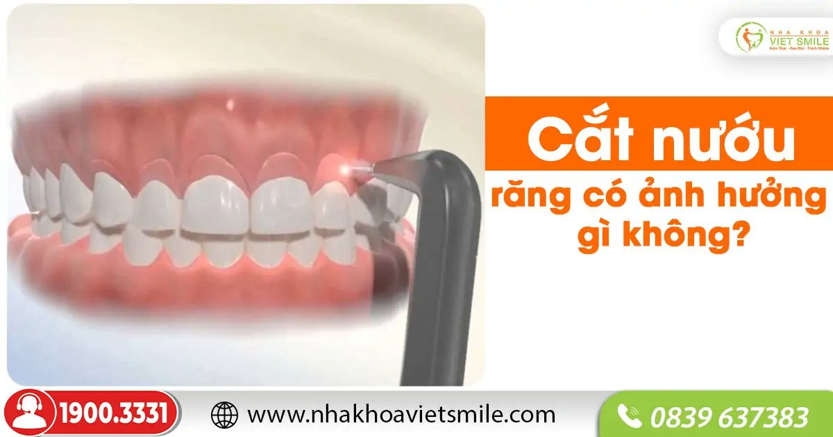 Cắt nướu răng có ảnh hưởng gì không?