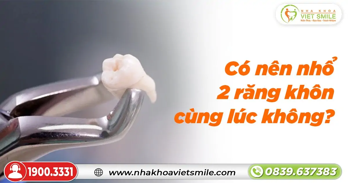 Có nên nhổ 2 răng khôn cùng lúc không?