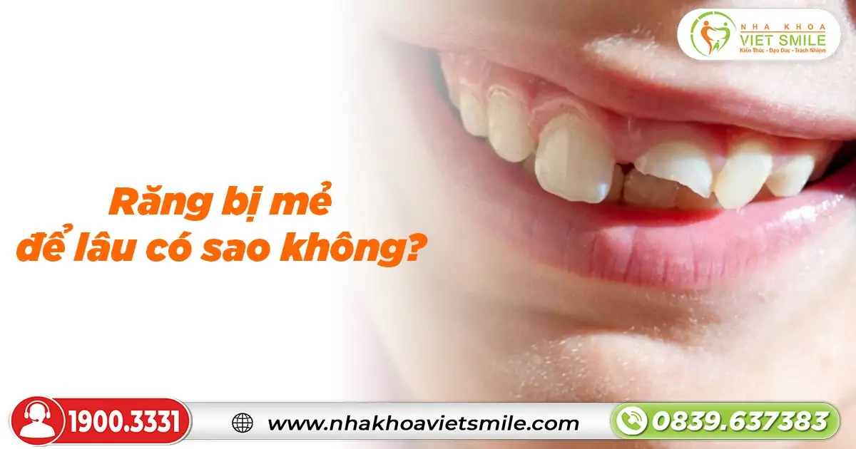 Răng bị mẻ để lâu có sao không?
