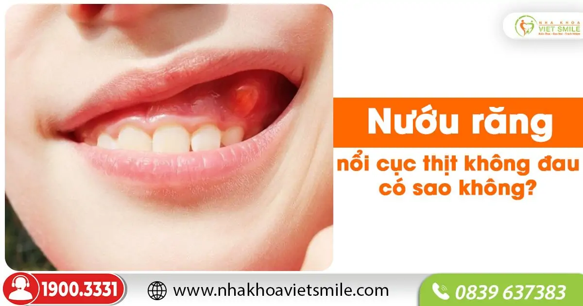 Nướu răng nổi cục thịt không đau có sao không?